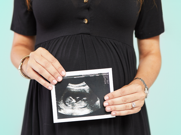 Pregnant women holding ultrasound